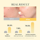 Medicube Kojic Acid Turmeric Brightening Gold Jelly Gel Mask for Hydrating Firming Skin