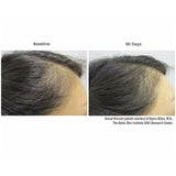 Viviscal Professional Strength Hair Growth Supplement, 60 tablets
