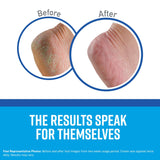 O'Keeffe's Healthy Feet Foot Cream, for Extremely Dry, Cracked Feet