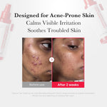 Medicube Power Soothing Spray Hypochlorous Acid Facial Mist For Sensitive Skin