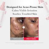 Medicube Power Soothing Spray Hypochlorous Acid Facial Mist For Sensitive Skin
