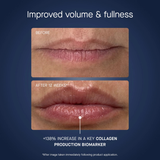 OneSkin OS-01 Lip Mask, 0.2 fl oz