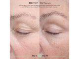BIOEFFECT EGF Serum, 0.50 fl oz