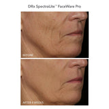 Dr Dennis Gross DRx SpectraLite FaceWare Pro